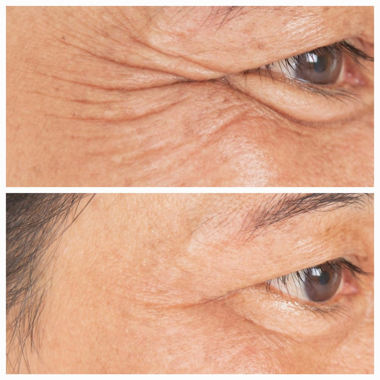 Anti-Aging