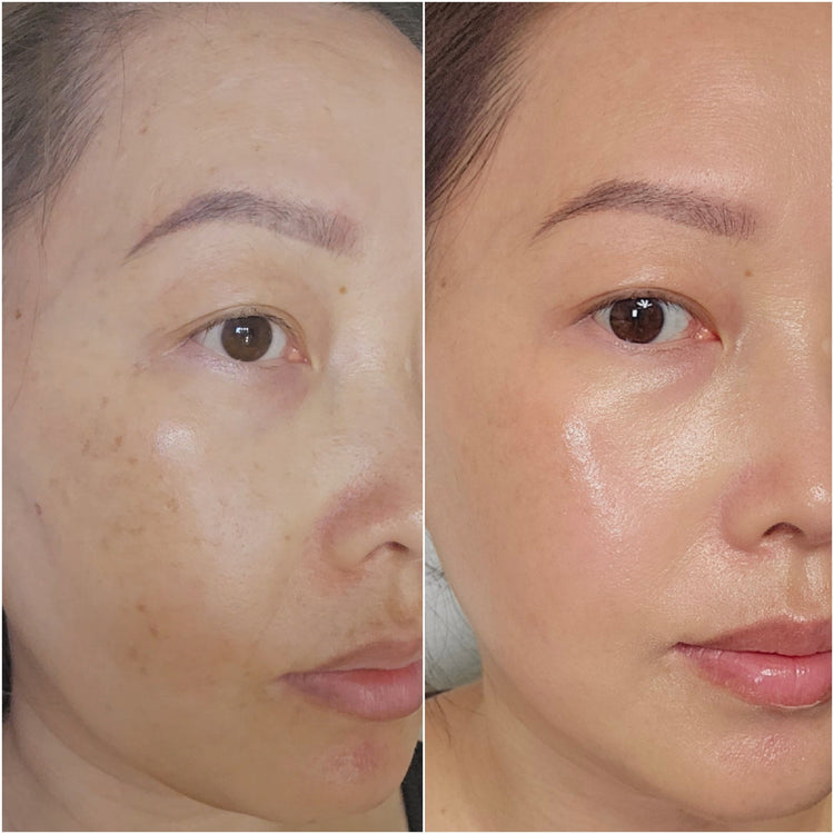 Dark Spots