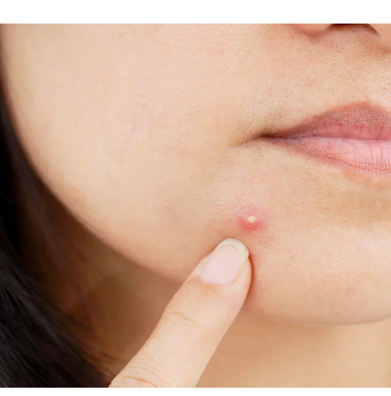 Clarifying Deep Pore Cleanser